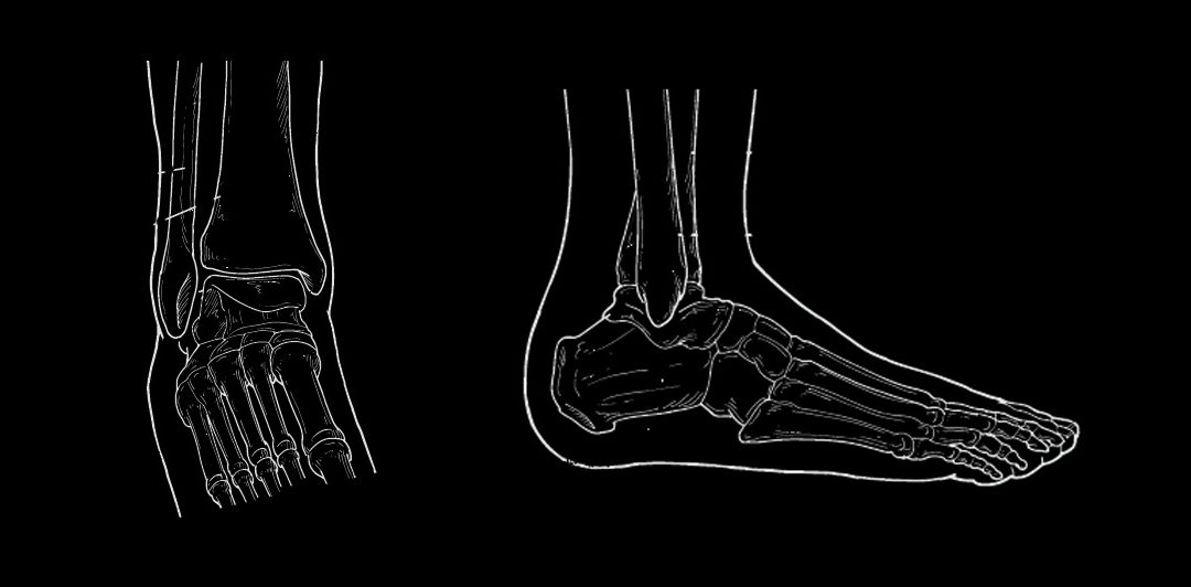 ANKLE FRACTURES