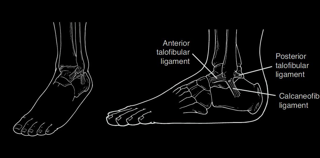 ANKLE SPRAIN