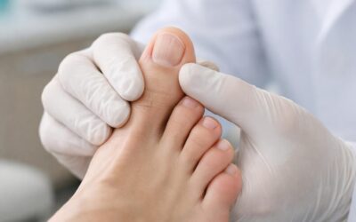 Bunion Treatment in Tucson, AZ | Tucson Foot and Ankle Institute
