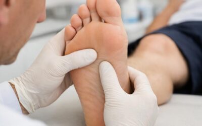 Corn and Callus Removal in Tucson, AZ | Foot Pressure Pain Guide